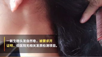 揭秘：头发自然卷的真正成因是什么？ 4