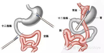 探索揭秘：'括囊无咎无誉'的深层含义，你了解多少？ 4