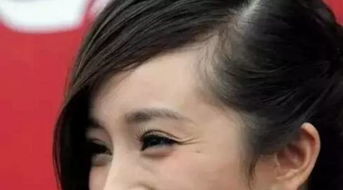 王婉菲的视力之谜：是否真的有问题？ 4