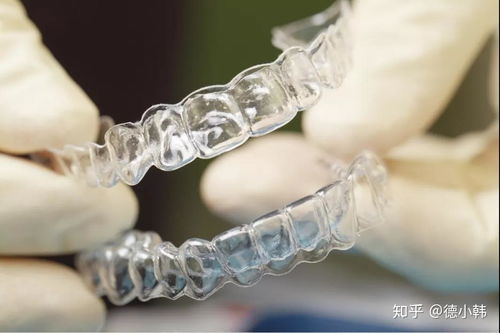 牙套保持器有哪些种类？ 2