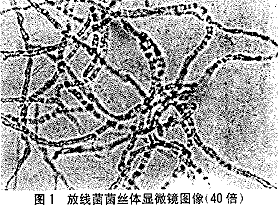 揭秘：实验室培育放线菌的首选“营养土壤”是什么？ 3