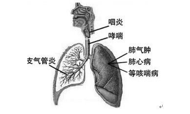 慢性支气管炎的有效治疗策略揭秘 2