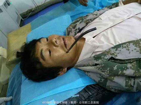 颈部贯通伤的奥秘：你不可不知的严重伤害解析 2