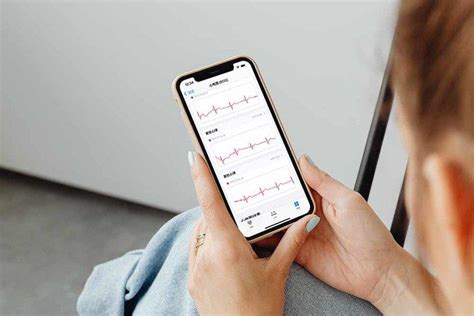 iWatch心电图功能全解析：轻松掌握健康“心”密码 3