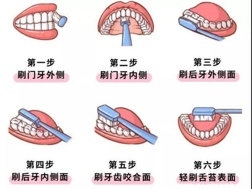 电动牙刷使用秘籍：图解正确刷牙步骤，让口腔清洁更高效！ 2