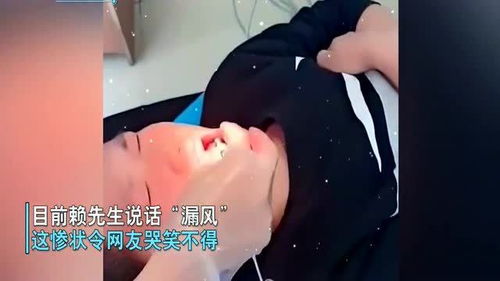 看完《长津湖》学吃冻土豆导致拔牙，哪些人不适合这样做？ 4