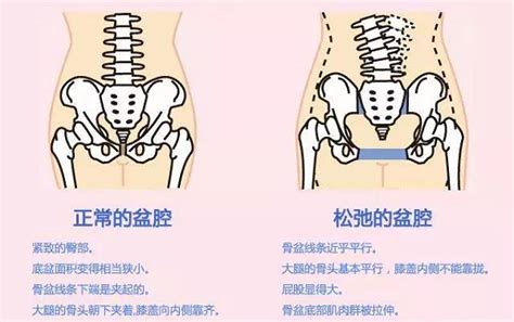 产后屁股变大？解锁高效恢复秘诀！ 4